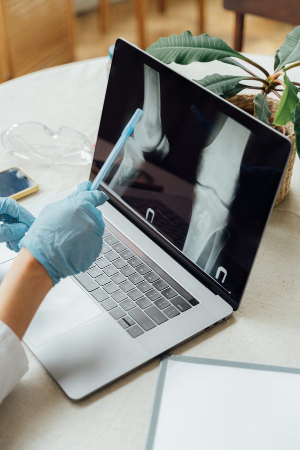 Quel est le Mac OS le plus stable ?